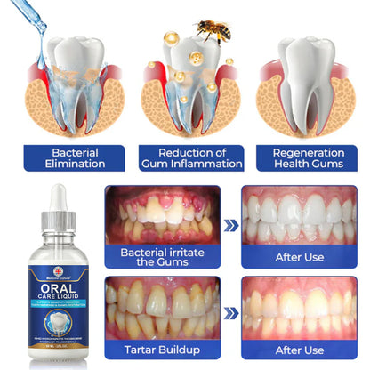 🌿🦷Oral Care Liquid– Effectively treats enamel damage, gum inflammation, toothaches, sensitive teeth, gum bleeding, periodontitis, cavities, mouth ulcers, and bad breath.