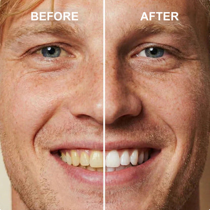🆙🦷Instant Teeth Whitening Polish  - Enamel Safe Tooth Gloss for Yellow Teeth Stain Removal - Fluoride-Free & Sensitivity Free