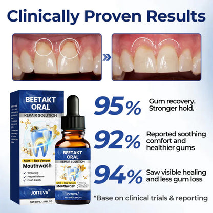 💡JOITUVA®   Oral Repair Solution, Bee Venom  Concentrated Drops for R   eceding Gums, Bleeding & Plaque, Advanced Mouthwash Alternativ