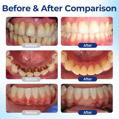 🦷💧Oral Care Liquid– Effectively treats enamel damage, gum inflammation, toothaches, sensitive teeth, gum bleeding, periodontitis, cavities, mouth ulcers, and bad breath.