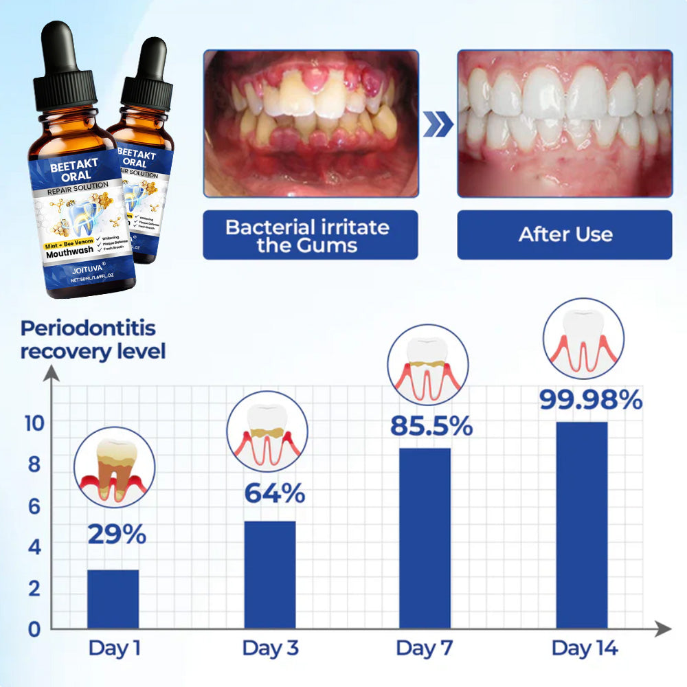 💡JOITUVA®   Oral Repair Solution, Bee Venom  Concentrated Drops for R   eceding Gums, Bleeding & Plaque, Advanced Mouthwash Alternativ