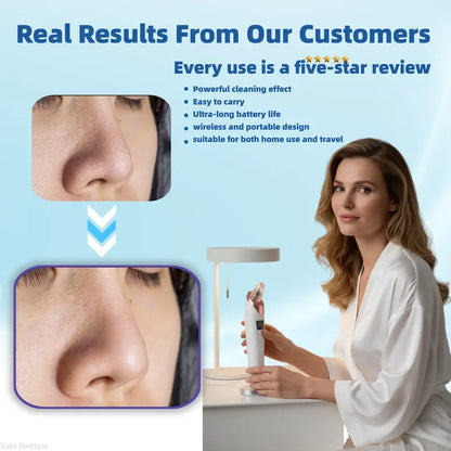 🆙Electric Pore Vacuum & Blackhead Remover – Rechargeable Spot Extractor Tool Setf