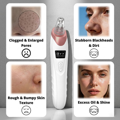 🆙Electric Pore Vacuum & Blackhead Remover – Rechargeable Spot Extractor Tool Setf